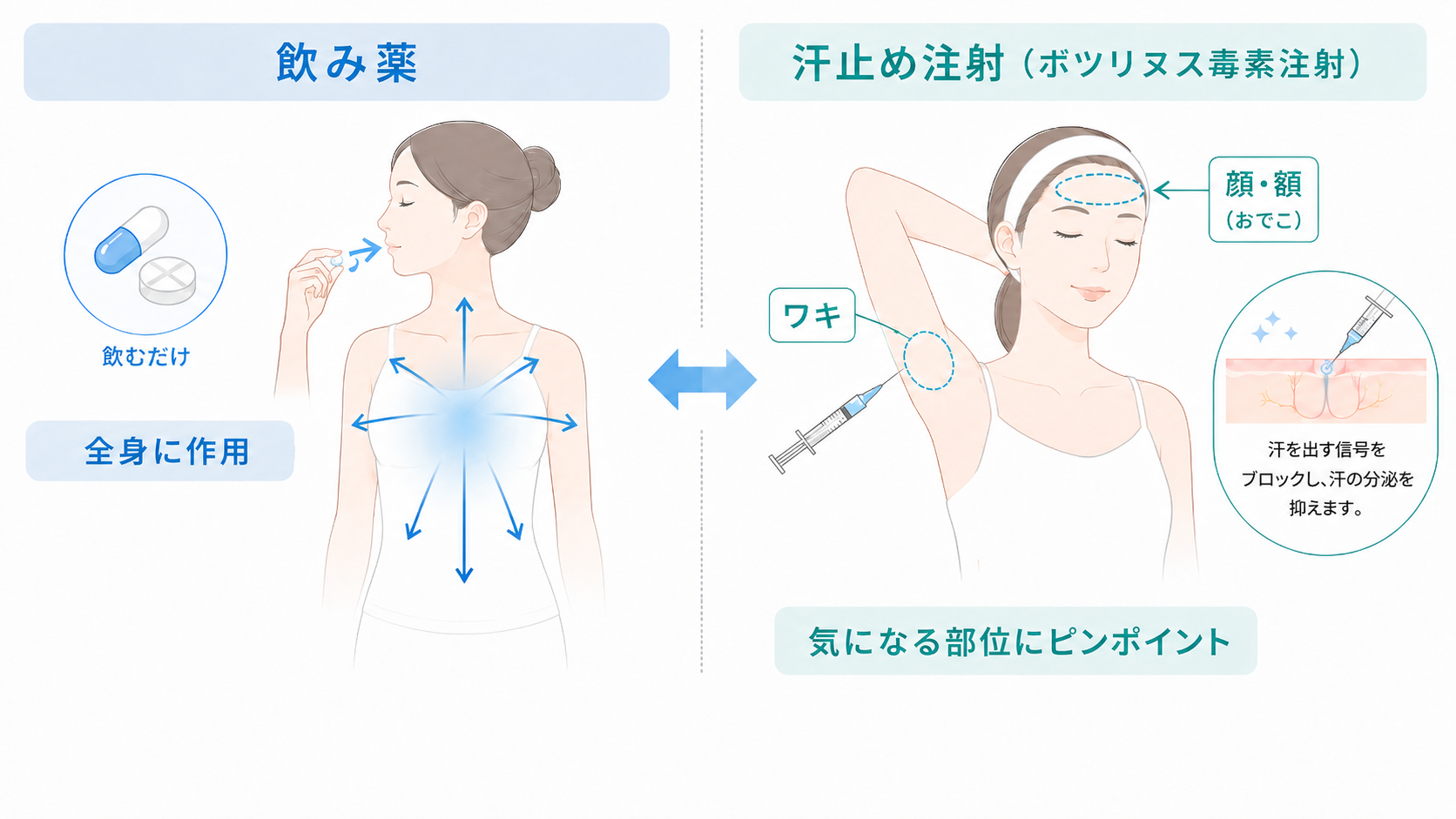 飲み薬と汗止め注射の効き方の違い。飲み薬は全身に作用し、注射は顔・ワキなど気になる部位にピンポイントで作用することを示した図解